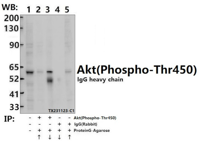 Phospho-AKT Pan (Thr450, Thr451, Thr447) Antibody in Immunoprecipitation (IP)