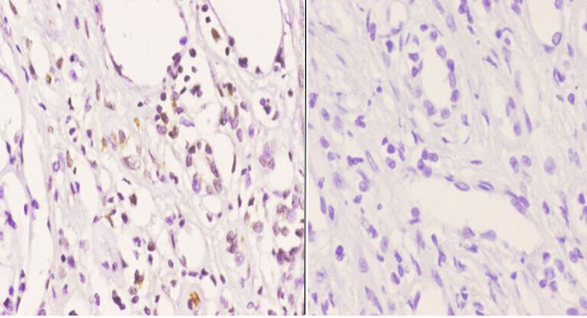 Phospho-AKT Pan (Thr450, Thr451, Thr447) Antibody in Immunohistochemistry (Paraffin) (IHC (P))