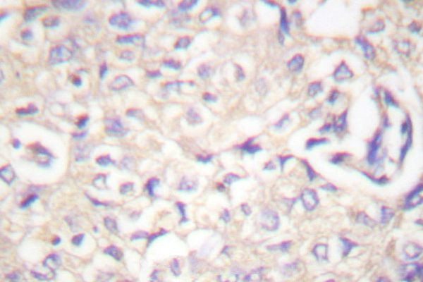 Phospho-c-Cbl (Tyr774) Antibody in Immunohistochemistry (Paraffin) (IHC (P))