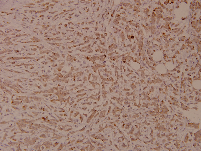 Phospho-INSR (Tyr1355) Antibody in Immunohistochemistry (Paraffin) (IHC (P))