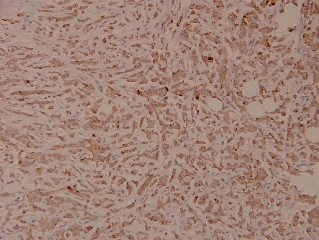 Phospho-INSR (Tyr1355) Antibody in Immunohistochemistry (Paraffin) (IHC (P))