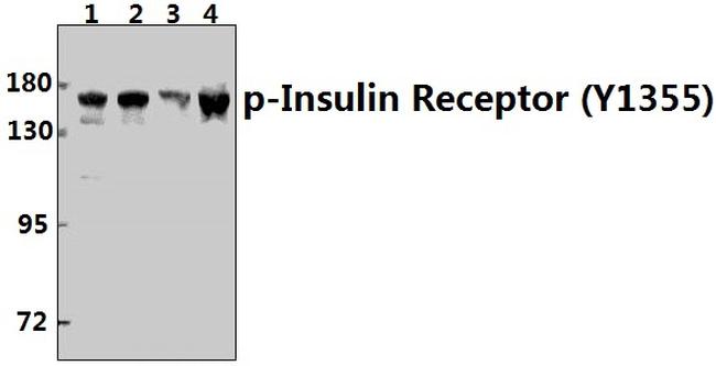 Phospho-INSR (Tyr1355) Antibody in Western Blot (WB)