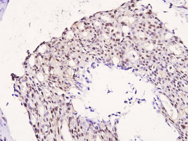 Phospho-IRS1 (Ser323) Antibody in Immunohistochemistry (Paraffin) (IHC (P))