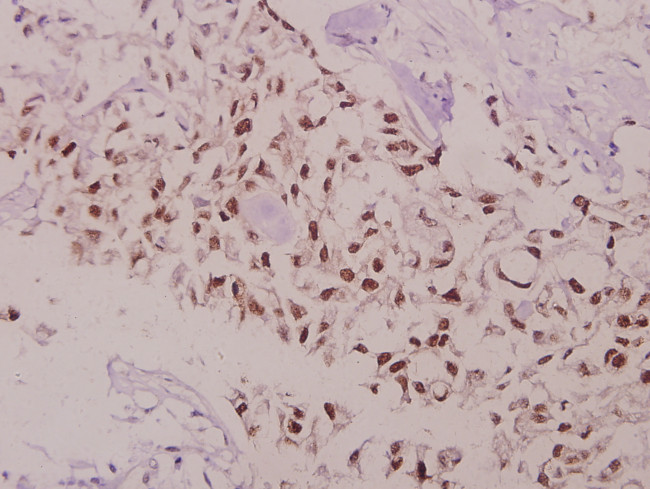 Phospho-Bcl-2 (Thr69) Antibody in Immunohistochemistry (Paraffin) (IHC (P))