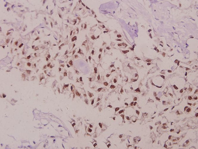 Phospho-Bcl-2 (Thr69) Antibody in Immunohistochemistry (Paraffin) (IHC (P))