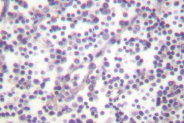 Phospho-Caspase 3 (Ser150) Antibody in Immunohistochemistry (Paraffin) (IHC (P))