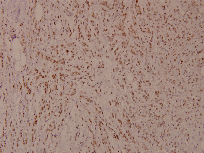 Phospho-MiTF (Ser180) Antibody in Immunohistochemistry (Paraffin) (IHC (P))