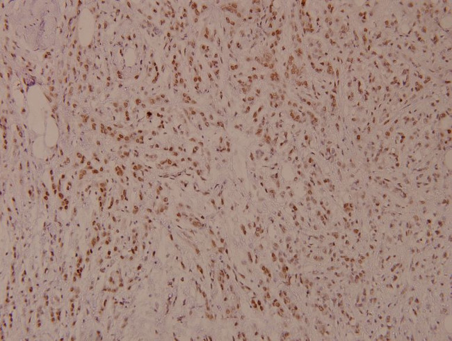 Phospho-MiTF (Ser180) Antibody in Immunohistochemistry (Paraffin) (IHC (P))