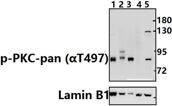 Phospho-PKC Pan (Thr497) Antibody in Western Blot (WB)