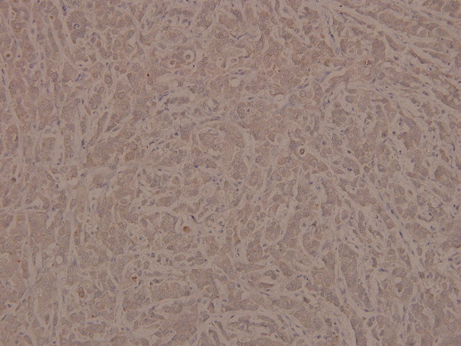 Phospho-INSR (Tyr1361) Antibody in Immunohistochemistry (Paraffin) (IHC (P))