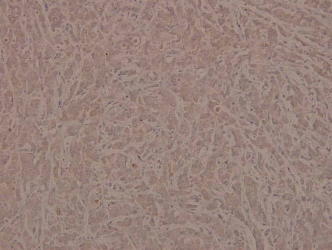 Phospho-INSR (Tyr1361) Antibody in Immunohistochemistry (Paraffin) (IHC (P))