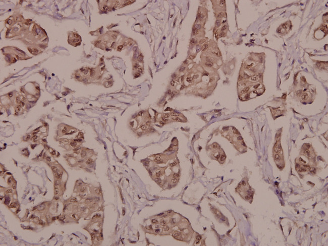 Phospho-PPAR gamma (Ser112) Antibody in Immunohistochemistry (Paraffin) (IHC (P))