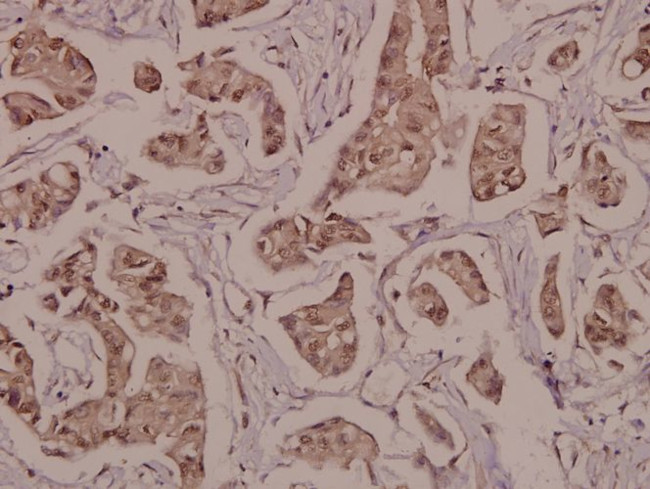 Phospho-PPAR gamma (Ser112) Antibody in Immunohistochemistry (Paraffin) (IHC (P))