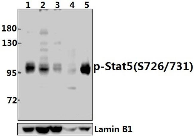 Phospho-STAT5 alpha/beta (Ser726, Ser731) Antibody in Western Blot (WB)