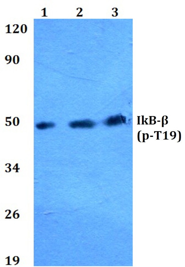 Phospho-IkB beta (Thr19) Antibody in Western Blot (WB)