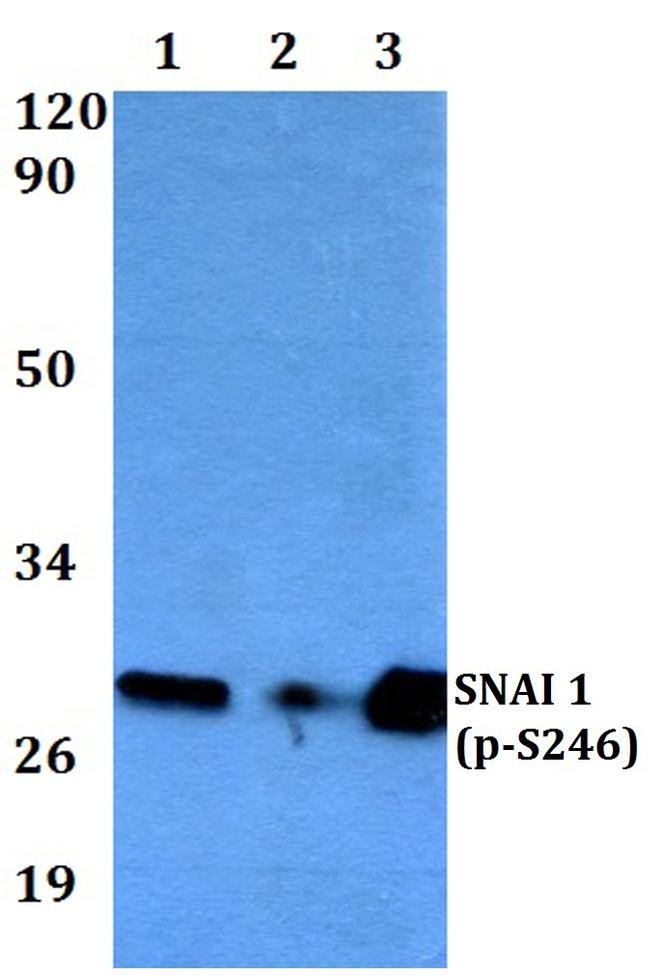 Phospho-SNAIL (Ser246) Antibody in Western Blot (WB)