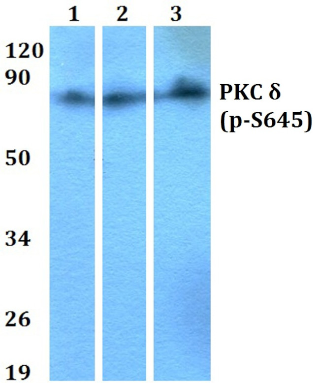 Phospho-PKC delta (Ser645) Antibody in Western Blot (WB)