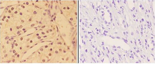 Phospho-AKT Pan (Tyr315, Tyr316, Tyr312) Antibody in Immunohistochemistry (Paraffin) (IHC (P))