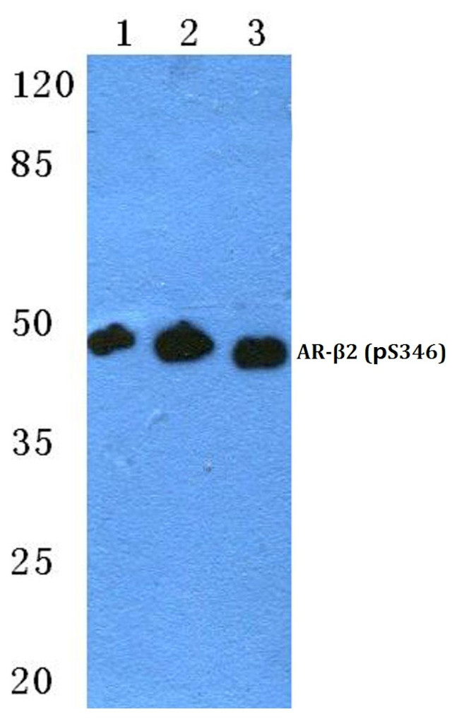 Phospho-beta-2 Adrenergic Receptor (Ser346) Antibody in Western Blot (WB)