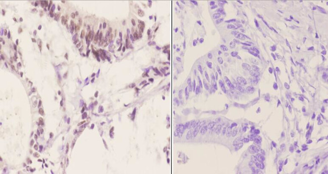 Phospho-ATF2 (Ser498) Antibody in Immunohistochemistry (Paraffin) (IHC (P))