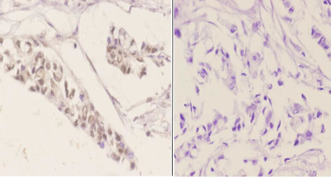 Phospho-ATF2 (Ser498) Antibody in Immunohistochemistry (Paraffin) (IHC (P))