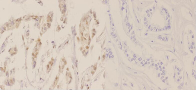 Phospho-NPM1 (Thr234) Antibody in Immunohistochemistry (Paraffin) (IHC (P))