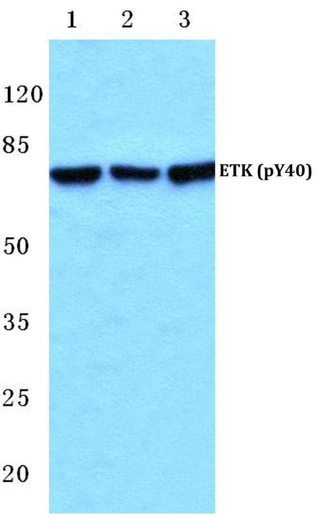 Phospho-ETK (Tyr40) Antibody in Western Blot (WB)