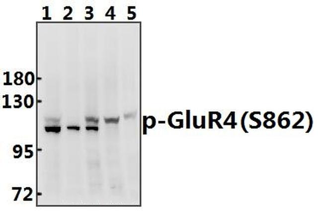 Phospho-GluR4 (Ser862) Antibody in Western Blot (WB)