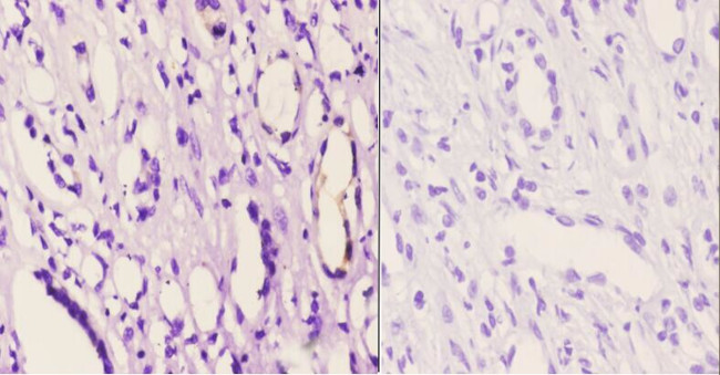 Phospho-GRB10 (Tyr67) Antibody in Immunohistochemistry (Paraffin) (IHC (P))