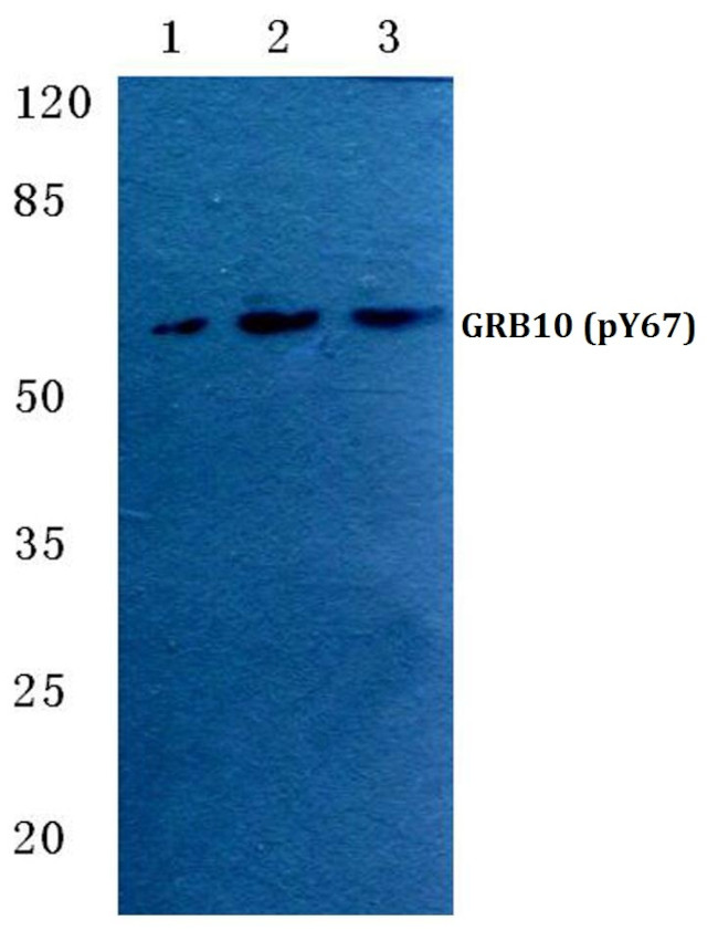 Phospho-GRB10 (Tyr67) Antibody in Western Blot (WB)