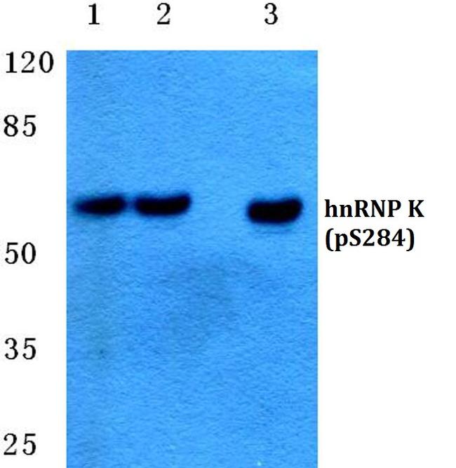 Phospho-hnRNP K (Ser284) Antibody in Western Blot (WB)