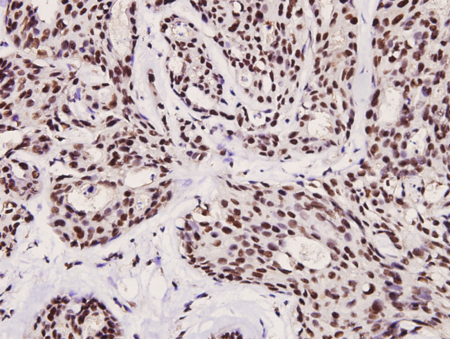 Phospho-FOXO3A (Ser253) Antibody in Immunohistochemistry (Paraffin) (IHC (P))