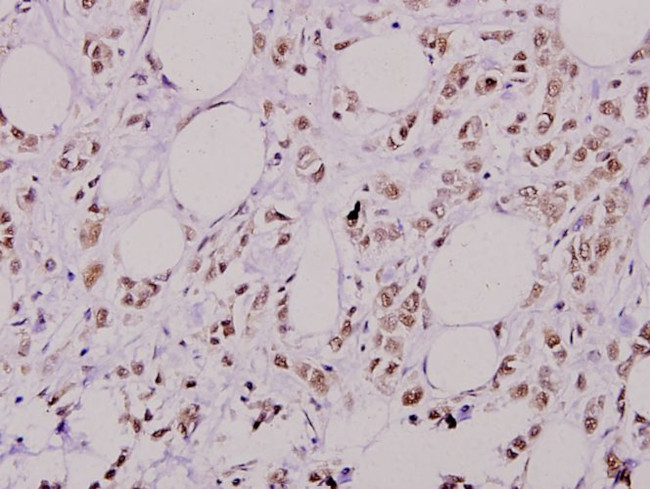 Phospho-AKT2 (Ser474) Antibody in Immunohistochemistry (Paraffin) (IHC (P))