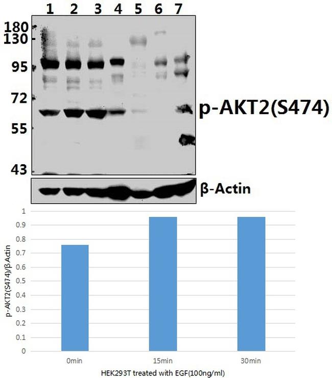 Phospho-AKT2 (Ser474) Antibody in Western Blot (WB)