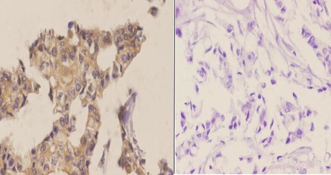 Phospho-ABL1/ABL2 (Tyr393, Tyr439) Antibody in Immunohistochemistry (Paraffin) (IHC (P))