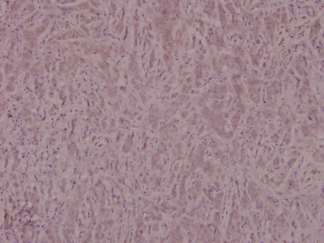 Phospho-IRS1 (Ser639) Antibody in Immunohistochemistry (Paraffin) (IHC (P))