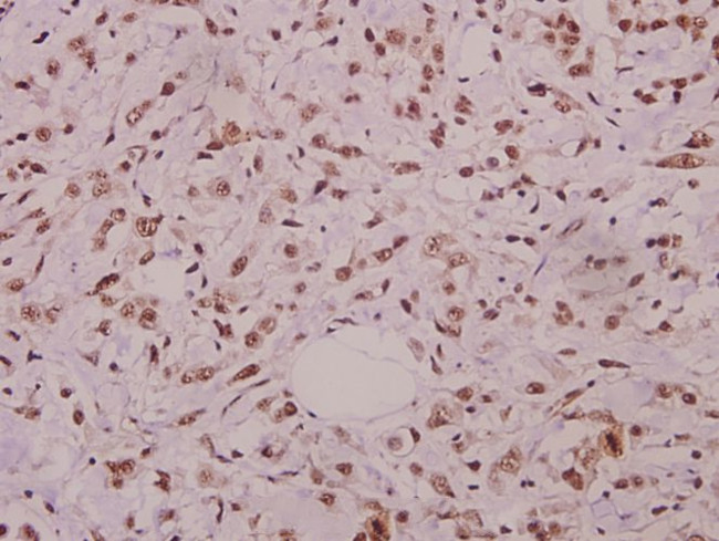 Phospho-JNK1/JNK2/JNK3 (Thr183) Antibody in Immunohistochemistry (Paraffin) (IHC (P))