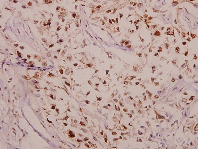 Phospho-CPI-17 (Thr38) Antibody in Immunohistochemistry (Paraffin) (IHC (P))