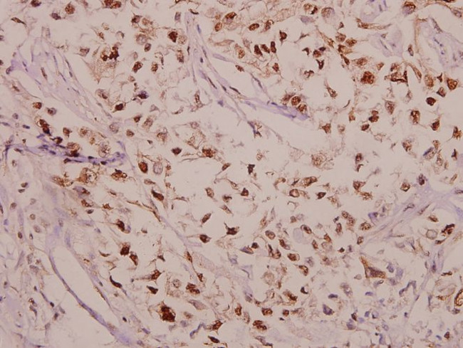 Phospho-CPI-17 (Thr38) Antibody in Immunohistochemistry (Paraffin) (IHC (P))