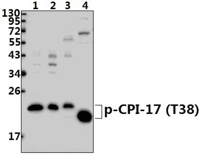 Phospho-CPI-17 (Thr38) Antibody in Western Blot (WB)