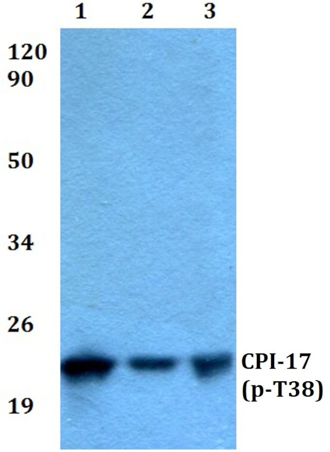 Phospho-CPI-17 (Thr38) Antibody in Western Blot (WB)