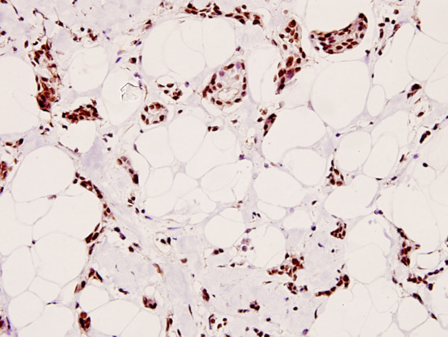 Phospho-CREB (Ser129) Antibody in Immunohistochemistry (Paraffin) (IHC (P))