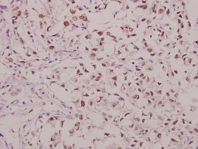 Phospho-GluR1 (Ser863) Antibody in Immunohistochemistry (Paraffin) (IHC (P))