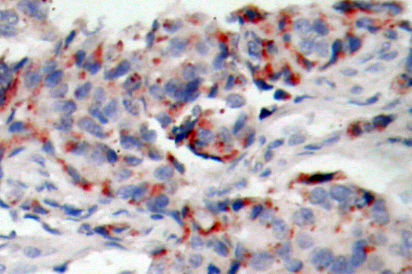 Phospho-JAK2 (Tyr221) Antibody in Immunohistochemistry (Paraffin) (IHC (P))