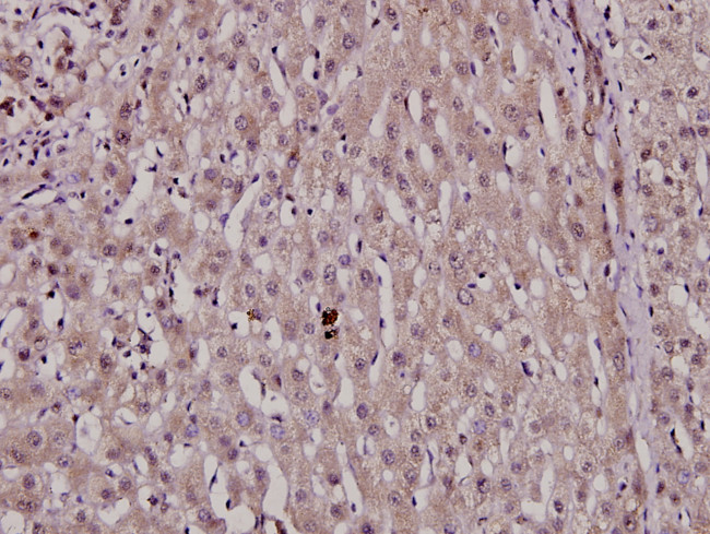 Phospho-HNF4A (Ser313) Antibody in Immunohistochemistry (Paraffin) (IHC (P))