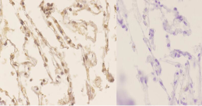 Phospho-LKB1 (Ser428) Antibody in Immunohistochemistry (Paraffin) (IHC (P))