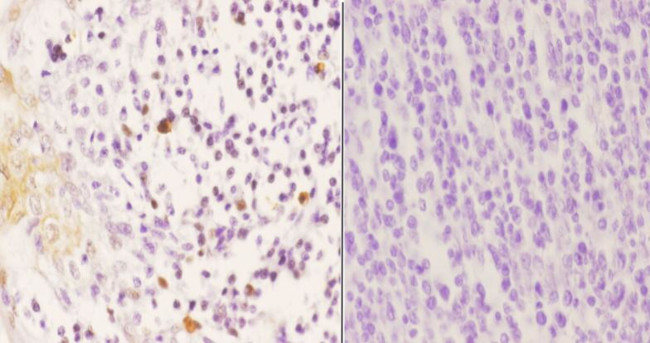 Phospho-p47phox (Ser370) Antibody in Immunohistochemistry (Paraffin) (IHC (P))