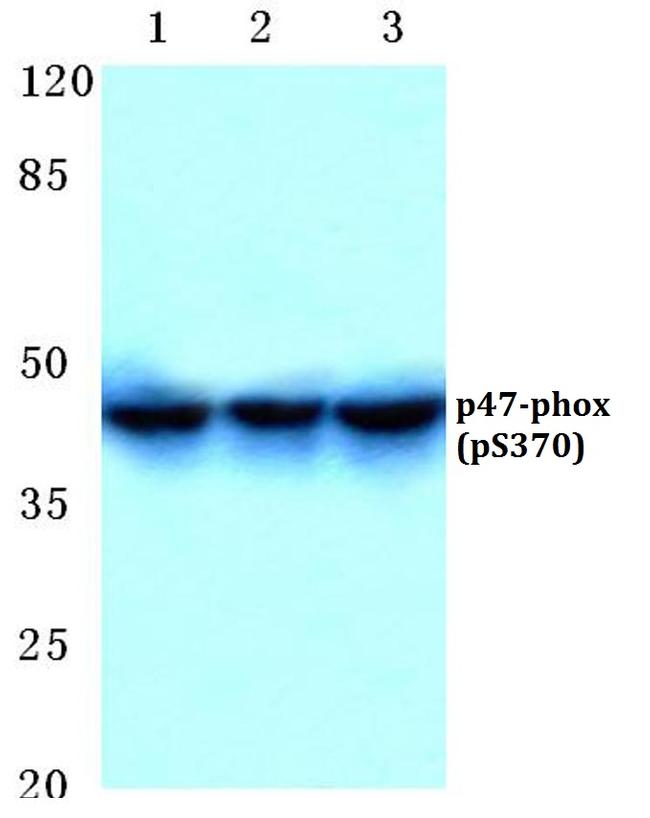 Phospho-p47phox (Ser370) Antibody in Western Blot (WB)