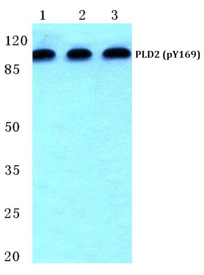 Phospho-PLD2 (Tyr169) Antibody in Western Blot (WB)