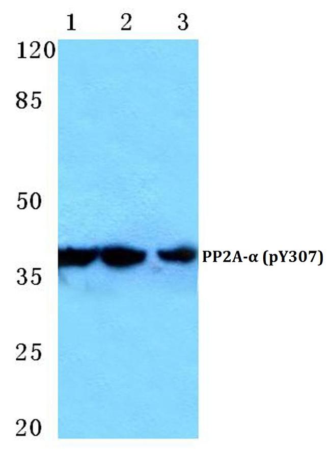 Phospho-PP2A alpha (Tyr307) Antibody in Western Blot (WB)